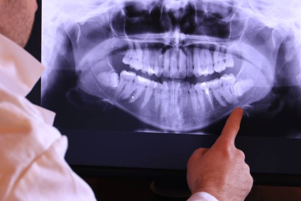 Best After-Hours Dental Trauma Care in Nome, AK